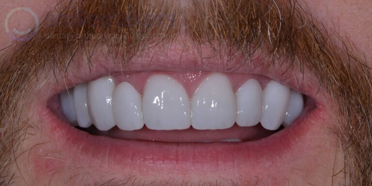 Combination 1 After Compressed 768x383 2