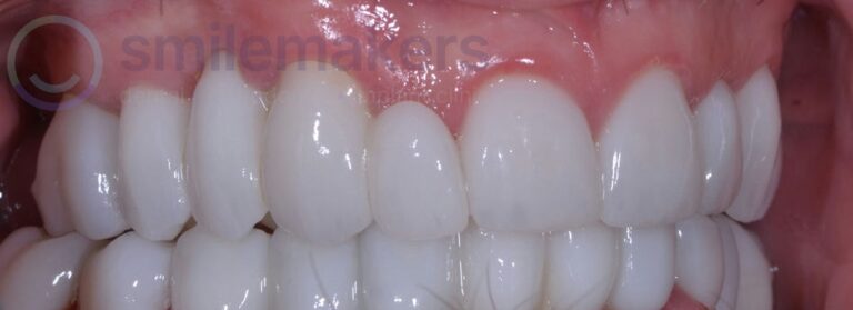 Combination 2 After Compressed 768x279 2