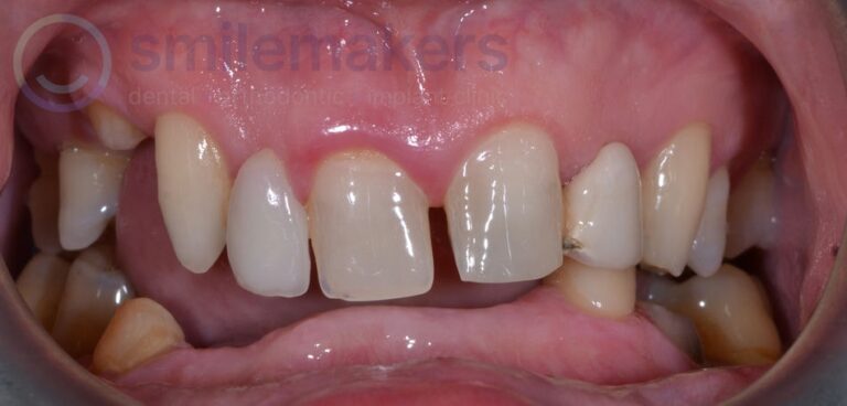 Combination 2 Before Compressed 768x368 2