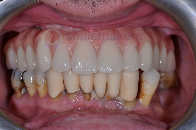 TIAD 2 After Compressed 768x512 2