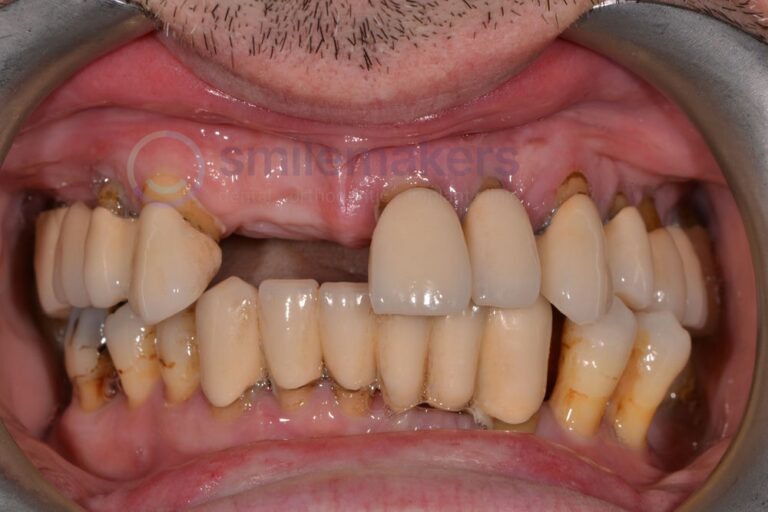 TIAD 2 Before Compressed 768x512 2