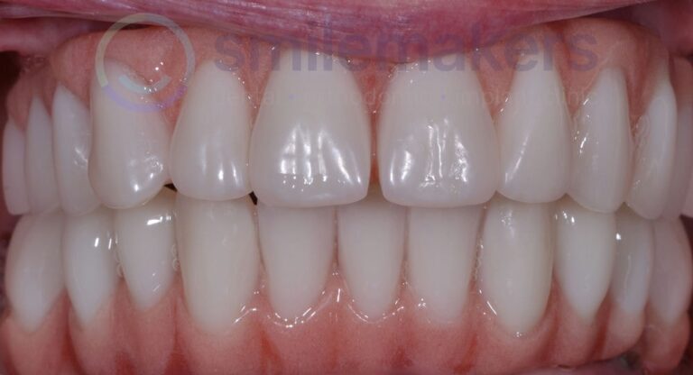 TIAD 3 After Compressed 768x416 2