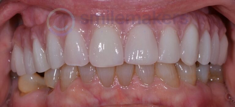 TIAD 4 After Compressed 768x352 2