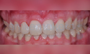 afr16 1