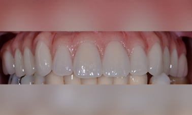 aftr2 8